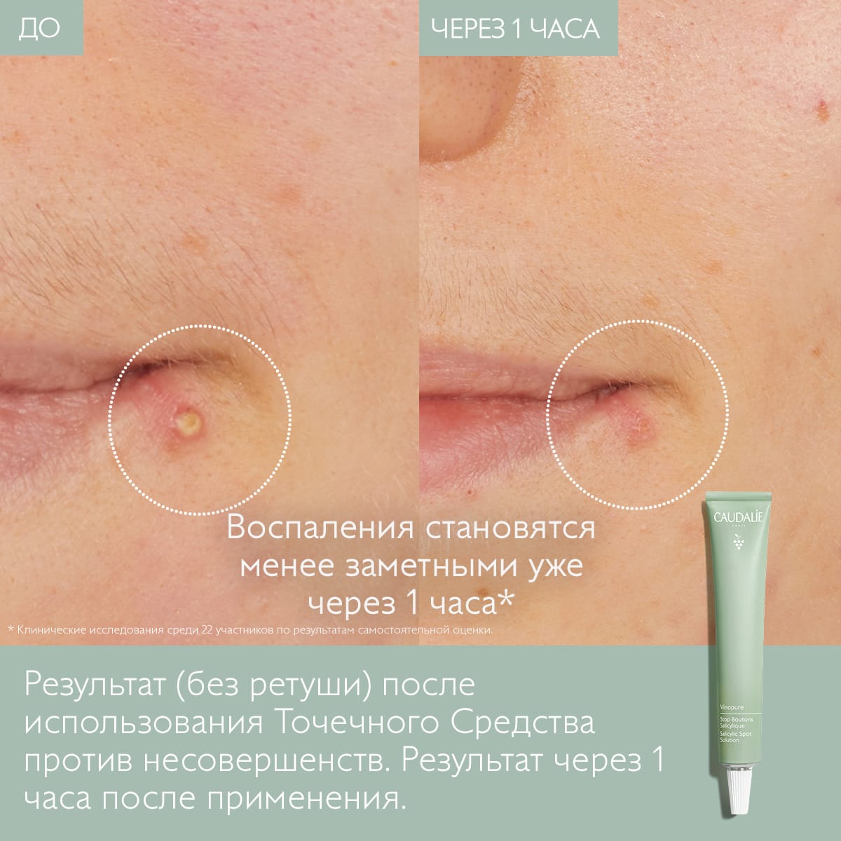 Точечный крем против несовершенств кожи с салициловой кислотой Vinopure Stop Boutons Salicylique, 15 мл - фото 3
