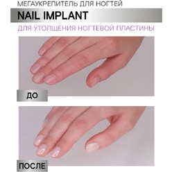 Мегаукрепитель для ногтей Luxvisage Nail Implant для утолщения ногтевой пластины, 9 г