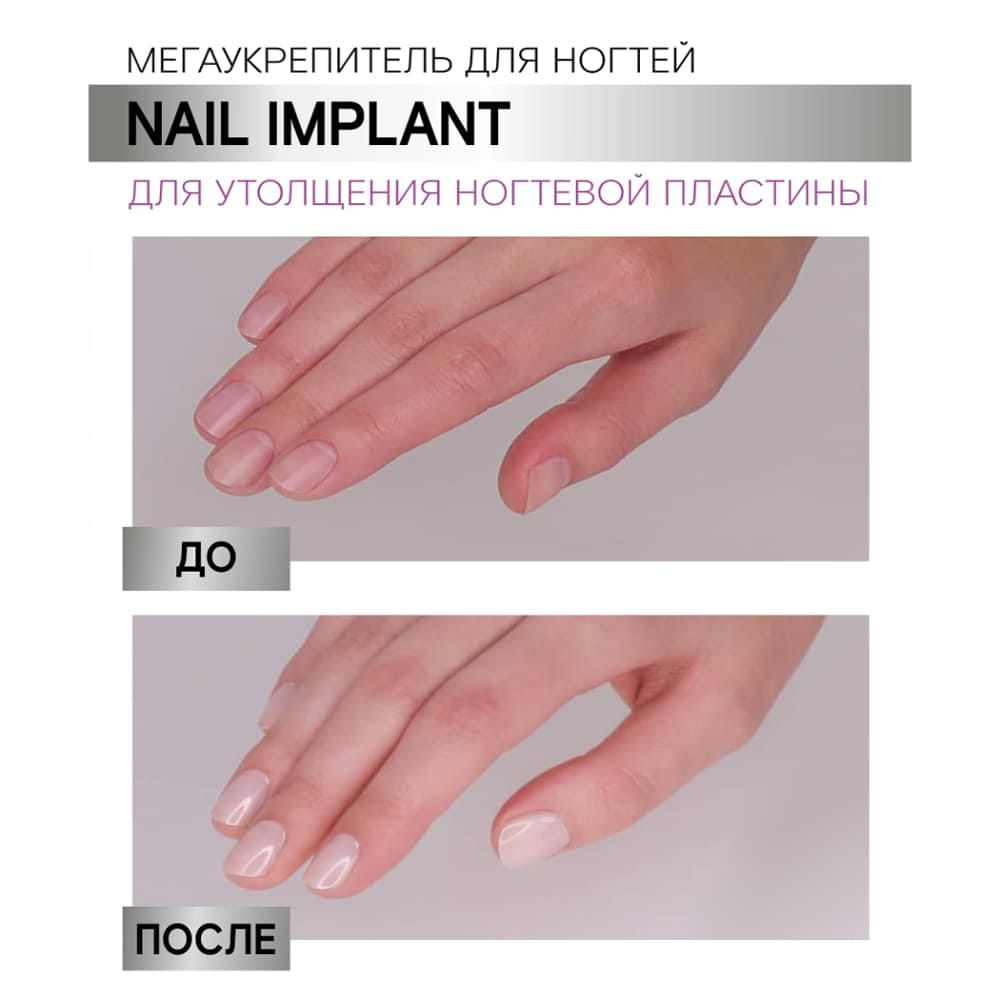Мегаукрепитель для ногтей Luxvisage Nail Implant для утолщения ногтевой пластины, 9 г