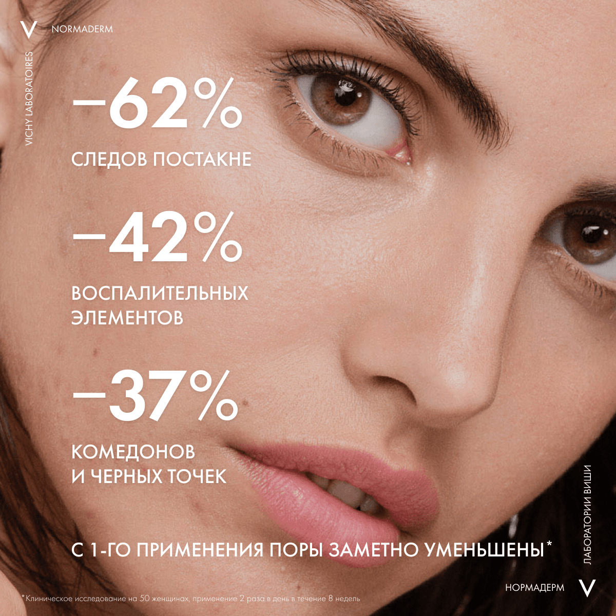 Корректирующий уход двойного действия Normaderm, 50 мл - фото 6